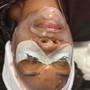 Facial