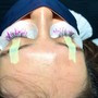 Eyelash Extension Removal