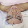 Acne Facial