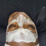 Dermaplaning