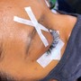 Facial Waxing