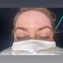 Eyelash Extension Removal