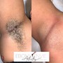 Underarm Wax