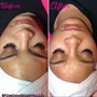 Facial