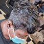 Scalp Treatment