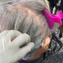 Scalp Treatment