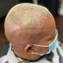 Scalp Treatment (Barber)