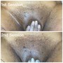 Brazilian Wax