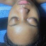 Microdermabrasion - Vajacial Add On