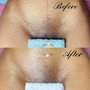 Men’s Brazilian Wax (P)