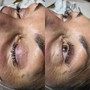 Eyelash Extension Removal