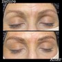 Microblading