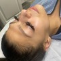 Let’s FACE it! (Microdermabrasion + High Frequency Facial)