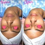 Facial