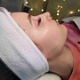 Dermaplaning Glow