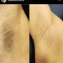 Brazilian Wax, Vajacial