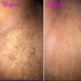 Brazilian Wax, Full leg Wax