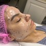 Custom Chemical Peel