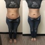 (10 Ultrasonic Cavitation & Wood Therapy)