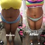 Booty Contouring $100 Special (wear stretch pants)