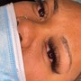 Eyelash Extension Removal