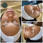 Dermaplane