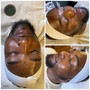 Acne Facial