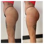 Supreme Butt Lift (3sessions)