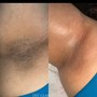 Men’s Brazilian Wax