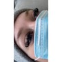 Eyelash Extension Removal