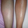 Full Leg Cellulite Treatment