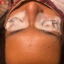 Back Facial