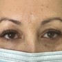 Eyelash Extension Removal