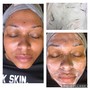 Dermaplaning Facial