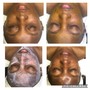 Enzyme Basic Facial