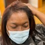 Scalp Treatment