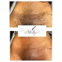 Women’s Brazilian Wax