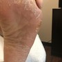 Gel Pedicure