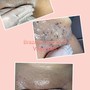 Underarm Wax