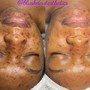 Blemish AND Balance Facial