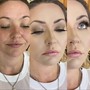 Eyebrow: Microblading