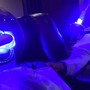 Teeth Whitening