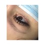 Eyelash Extension Removal