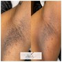 Underarm Wax