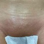 Vajacial, Brazilian Wax