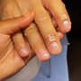 Nail Repair