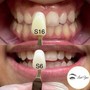 Teeth Whitening