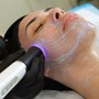 LED Light Therapy Facial