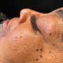 Acne Back Facial (bootcamp)