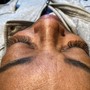 Acne Back Facial (bootcamp)